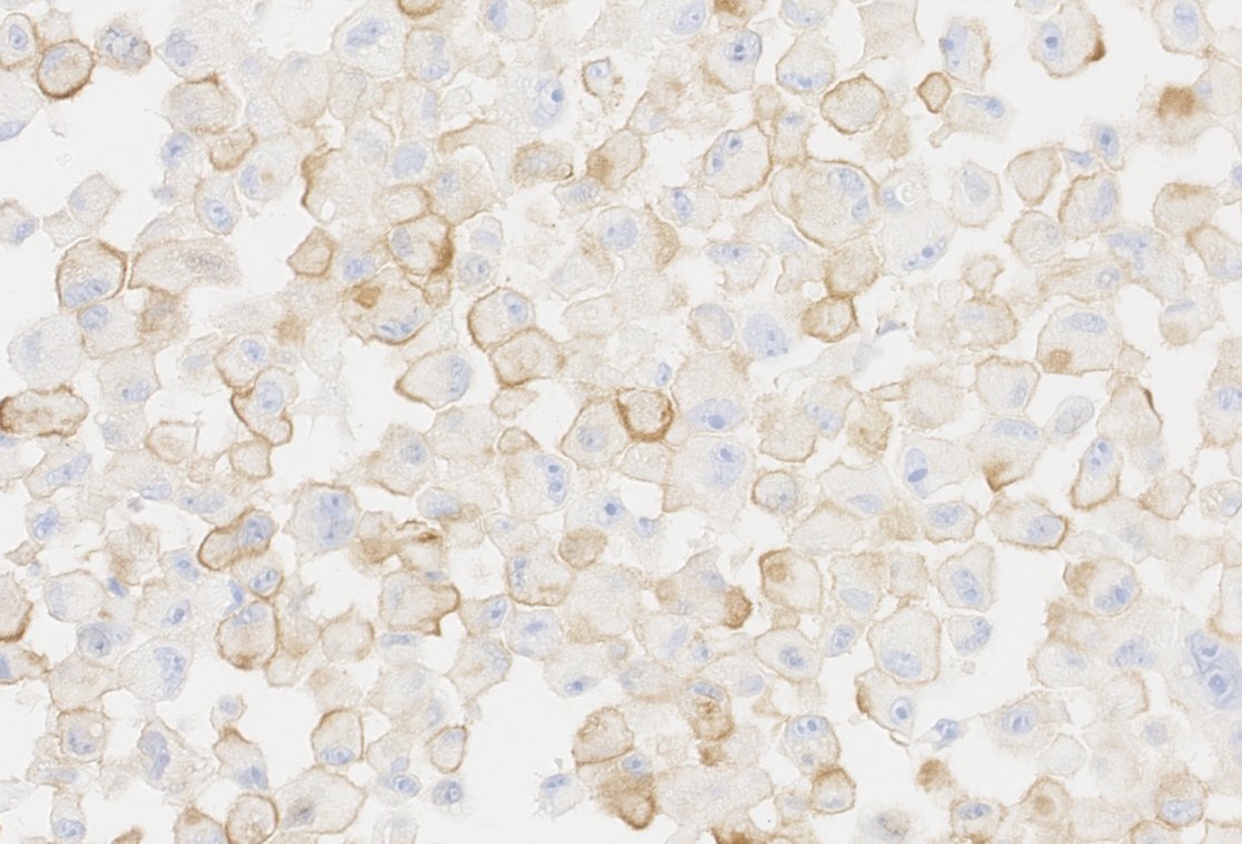 IRB Barcelona (@irbbarcelona) on Twitter photo 🔬#Chemotherapy becomes more efficient when senescent cells are eliminated by #immunotherapy.
✍️<a href="/josealbertold/">José Alberto López</a>, #SelimChaib, #ManuelSerrano et al.
📰<a href="/NatureCancer/">Nature Cancer</a>
📌DOI:10.1038/s43018-023-00712-x
➡️shorturl.at/frKN5
#IRBScience #AgingResearch #CancerResearch 🔬#Chemotherapy becomes more efficient when senescent cells are eliminated by #immunotherapy.
✍️<a href="/josealbertold/">José Alberto López</a>, #SelimChaib, #ManuelSerrano et al.
📰<a href="/NatureCancer/">Nature Cancer</a>
📌DOI:10.1038/s43018-023-00712-x
➡️shorturl.at/frKN5
#IRBScience #AgingResearch #CancerResearch