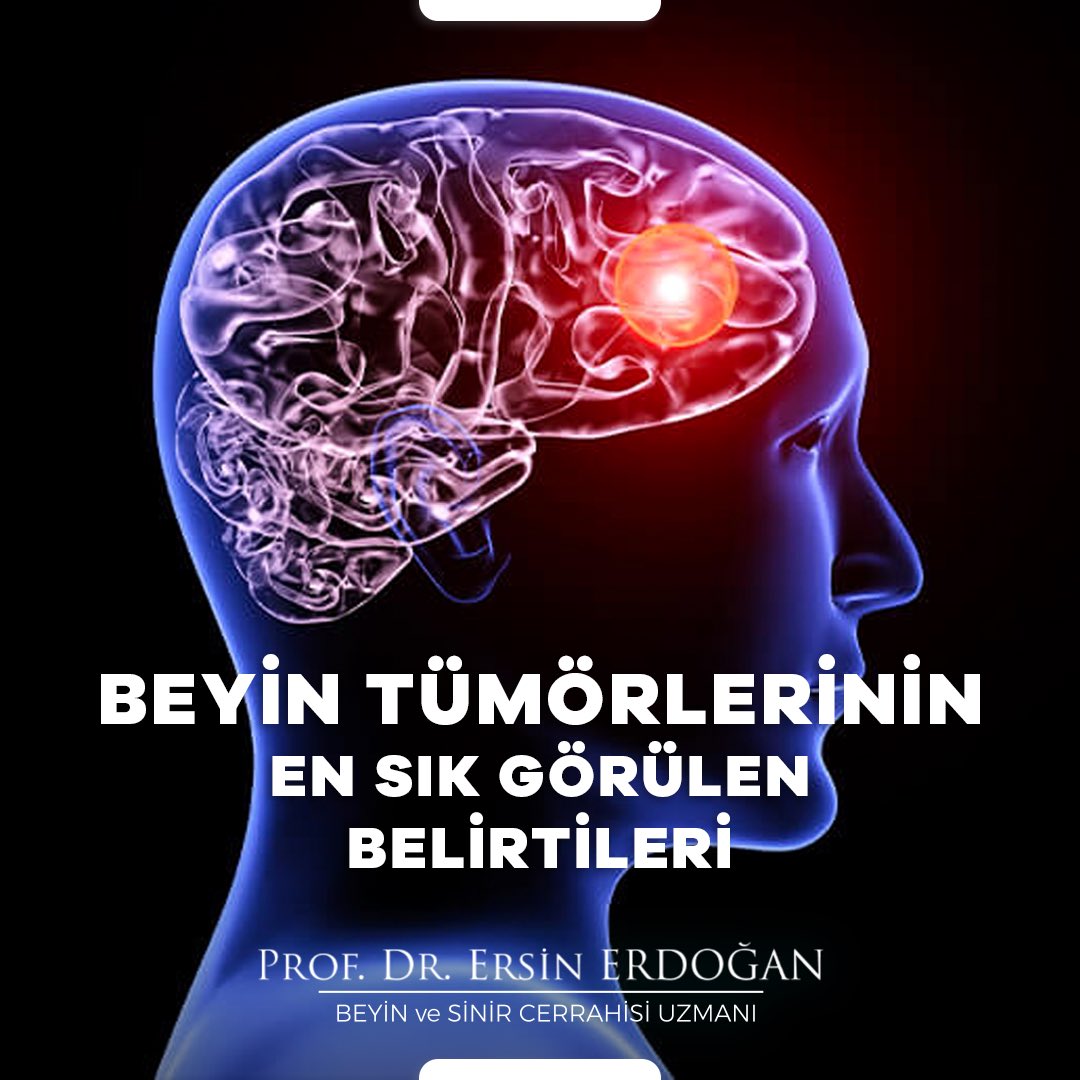 beyincerrahisi's tweet photo. ➤ Beyin tümörü, beynin kendi dokusunda yer alan hücrelerin farklılaşarak kontrolsüz bir şekilde çoğalmasıyla ya da vücudun farklı bir yerinde var olan kanser hücrelerinin kan dolaşımı yoluyla beyne ulaşarak bu bölgeye yayılmasıyla oluşan bir hastalıktır. https://t.co/xIF7Z24xx3