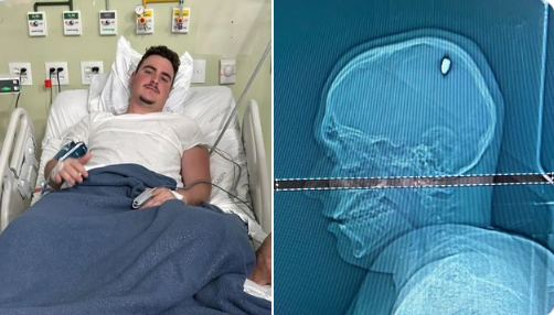 classichits1037's tweet image. A guy in Brazil is lucky to be alive after he went days without realizing he had a bullet in his head😲Take a ride on the #crazytrain here ⬇️👇🤪
iheart.com/podcast/1248-c…