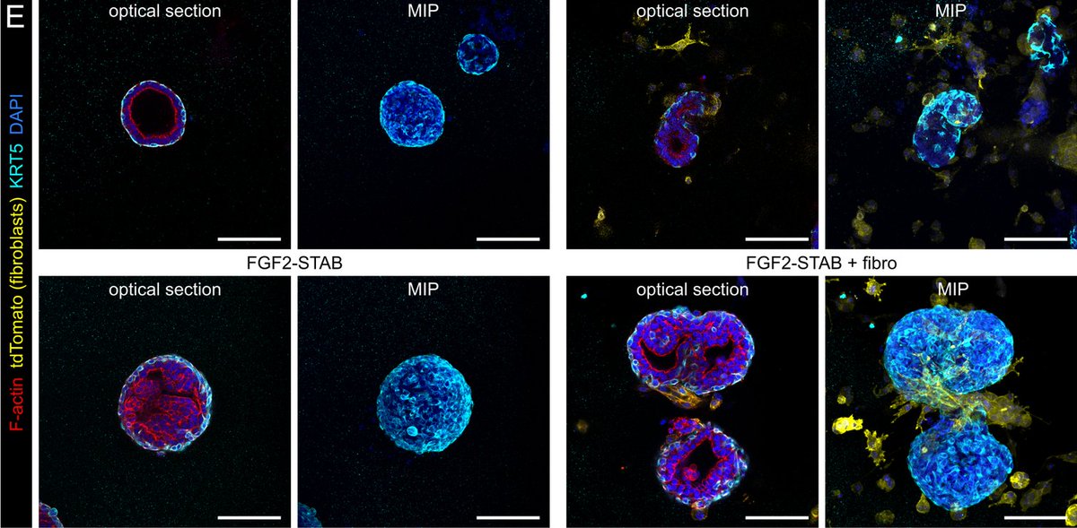 Scientists employed fibroblast-organoid 🧫 co-culture systems and time-lapse imaging 🖼️ to reveal that physical contact between fibroblasts and epithelial cells and fibroblast contractility is required to induce mammary epithelial branching. 

bit.ly/3S8BkFF