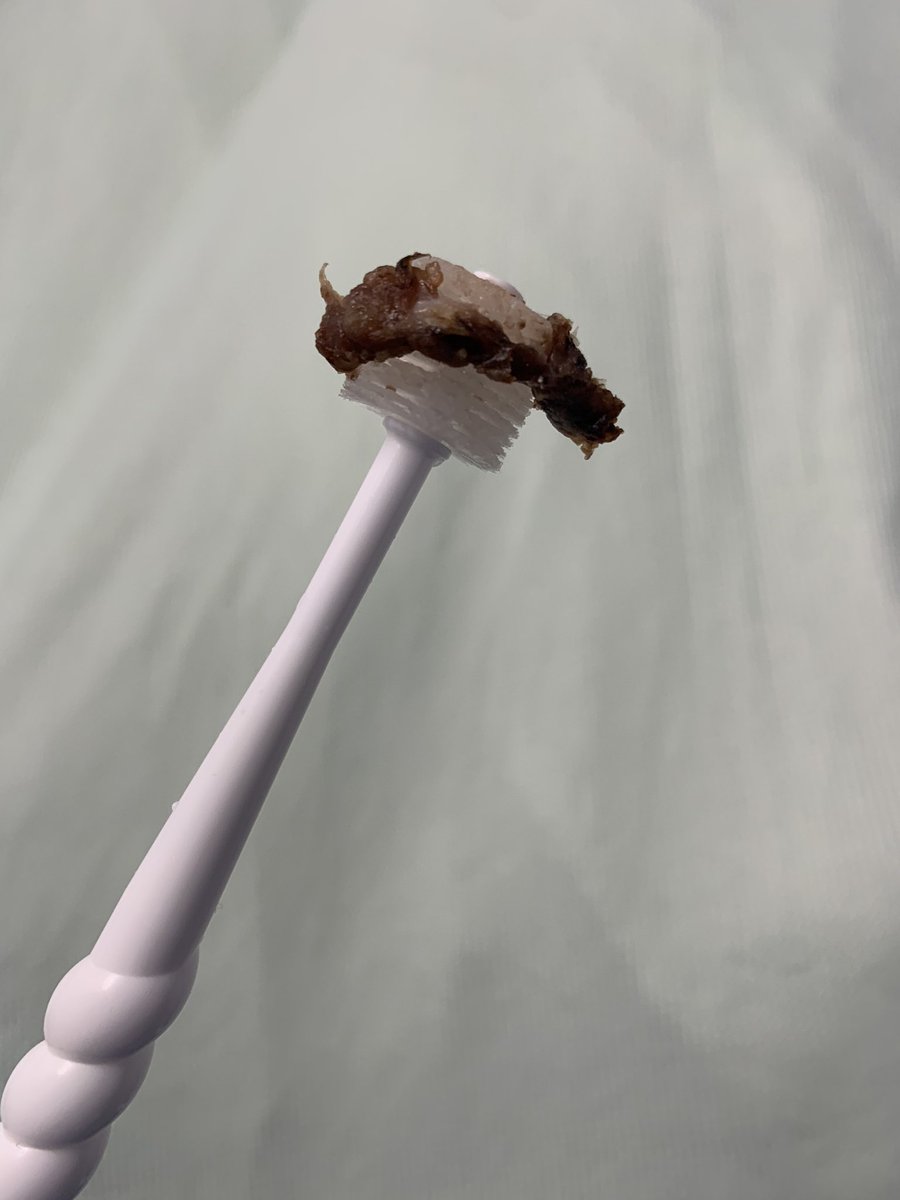 Sorry for anyone with a sensitive stomach, but #mouthcarematters for SO many different reasons:

🦷Oral hygiene
😀Pt comfort
🗣️Speech production
👅Swallowing
🫁Pulmonary/overall systemic health

#mySLTday