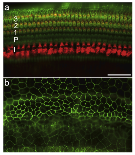 And our Hearing Restoration Project researchers used a cocktail of four genes to induce hair cell-like cells in the guinea pig model, see this summary with details and next steps/challenges: hearinghealthfoundation.org/blogs/combinat… #hearing #research #science #loveyourears #keeplistening