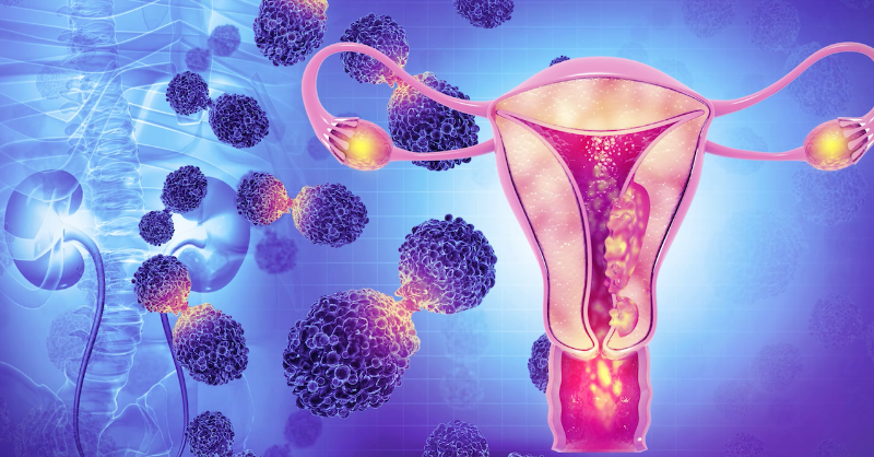 OSUCCC_James's tweet photo. Genetic research @OhioState could lead to groundbreaking #immunotherapy treatments for #EndometrialCancer patients.