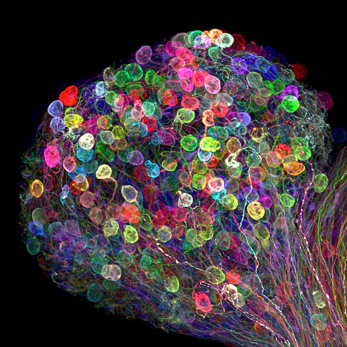 Microphotography unveils the hidden beauty of the microscopic world, revealing intricate details that amaze the mind. The wonders of science and technology never cease to inspire.

This part of an embryonic chick brain is coloured with the 'brainbow' genetic technique: