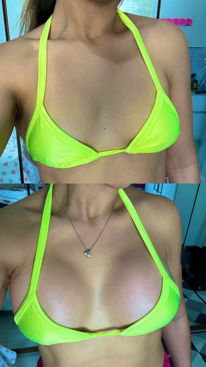 Já que tô de fraldas hj, eis o meu presentinho que me dei o luxo…
Amei o resultado e é isso que importa!