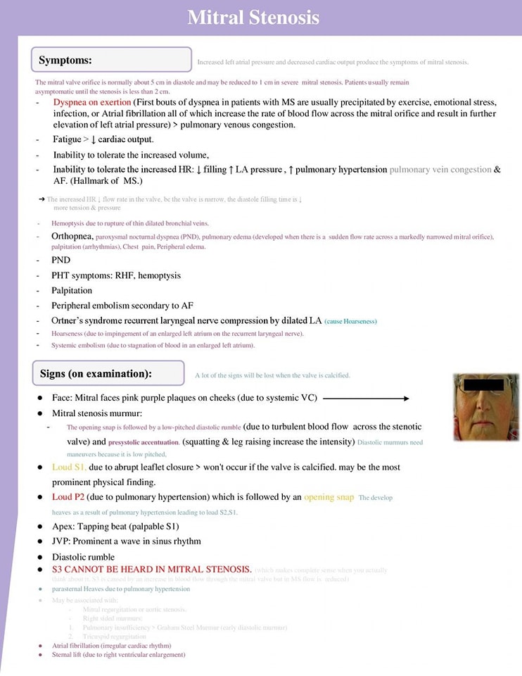 ZHeart11768530's tweet photo. MITRAL STENOSIS OVERVIEW 
 #MedEd #CardioEd #cardiology #CardioTwitter #MedTwitter #medtwitter #foamed #clinical #diagnosis #Comparison #PhysicalExam #Clinical https://t.co/cRilTP12jY