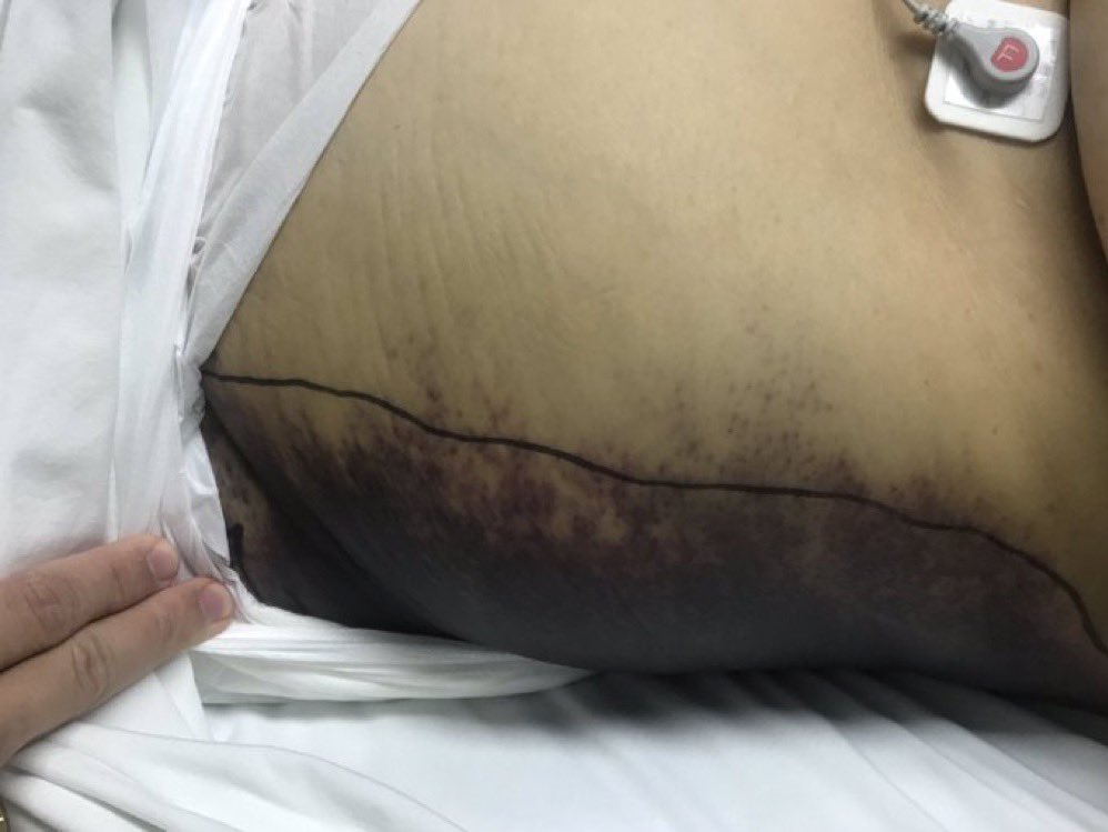 Dr Luis Felipe Cabrera Vargas MD FACS tweet media