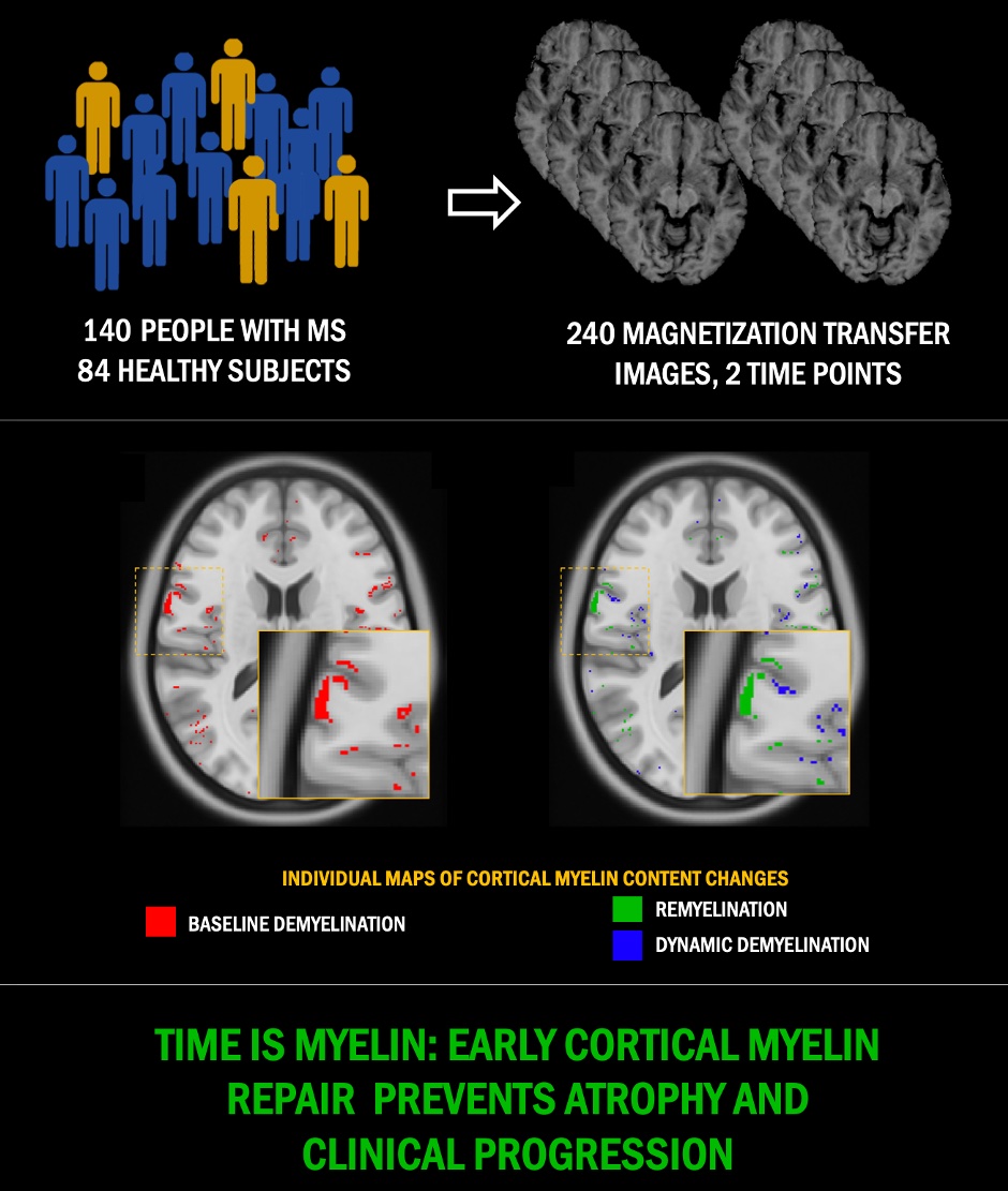 Lazzarotto et al. used advanced MRI to study cortical myelin loss and repair in 140 people with MS followed for 5 yrs, and conclude that early-stage myelin repair is effective at preventing long-term accumulation of irreversible clinical disability. tinyurl.com/47whkvrm