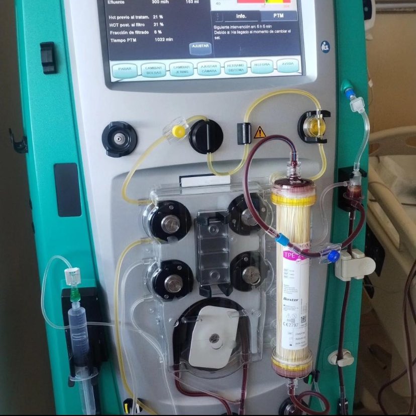 🚨🚨🚨Historic day for Nefro Gea. 

Our hospital's first Therapeutic Plasma Exchange. 

“Congratulations to our entire team!”

<a href="/HospitalGeaMx/">Hospital Gea Mx</a> 
#NephTwitter