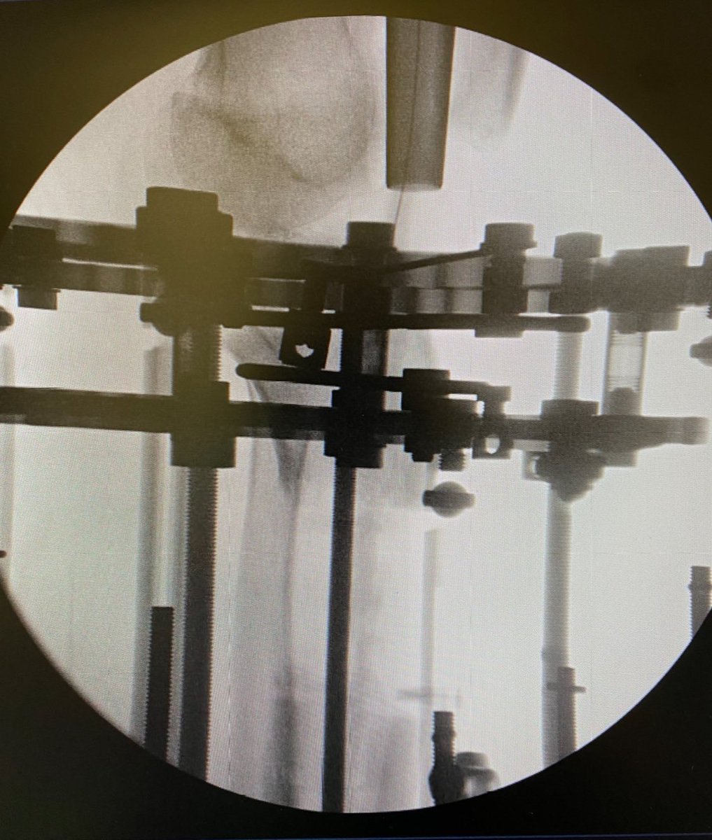 James A. Blair, MD, FAAOS, FACS tweet media