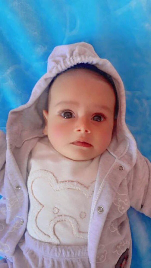El bebé palestino Jamal Al Kafarnah de 5 meses murió de hambre. Euro-Med Human Rights Monitor había advertido que el número de víctimas de la hambruna en Gaza está a punto de crecer, particularmente entre niños y ancianos, y agregó que Israel está utilizando el hambre como arma…
