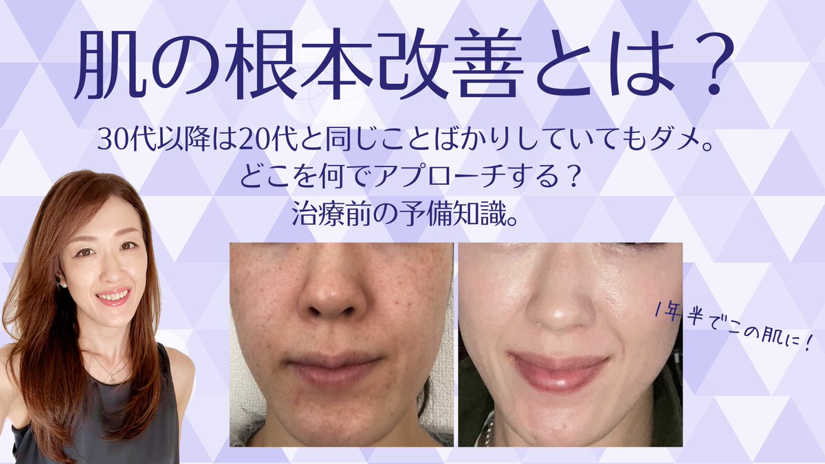 bikanbiyori_'s tweet image. ♦︎♦︎♦︎♦︎ 肌の根本改善とは♦︎♦︎♦︎♦︎

肌は確実に衰えていく。
・正しいクレンジングと洗顔
・紫外線対策
・お肌に良い食品を摂る
・睡眠をしっかりとる
そんなお手入れを繰り返しても30代以降の肌は衰え＞生活習慣・セルフケアで衰えが勝つ。…