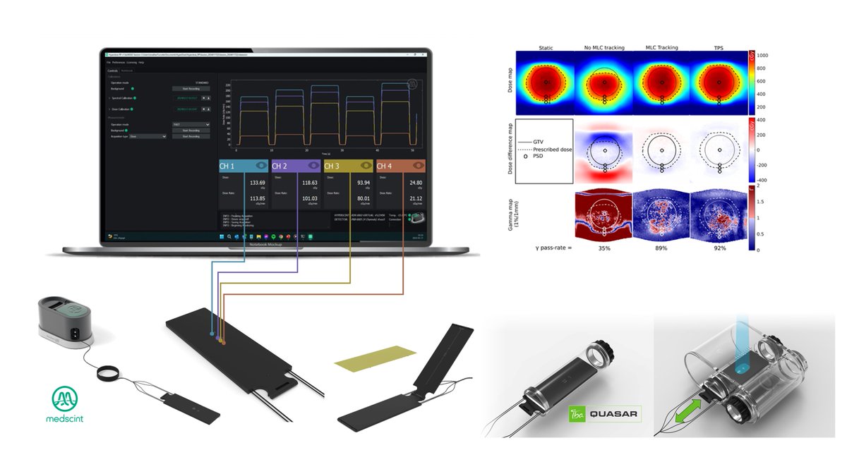 MEDSCINT (@medscint) on Twitter photo 📢 Exciting #MedPhys #MRLinac news!
Check out this cutting-edge adaptive radiotherapy 📄paper covering SPATIAL+ TEMPORAL+ MOTION dosimetry aspects (+beam-gating latency) ALL SIMULTANEOUSLY on <a href="/Elekta/">Elekta</a> 1.5T Unity
OPEN-ACCESS on <a href="/aapmHQ/">American Association of Physicists in Medicine</a> Medical Physics👇
aapm.onlinelibrary.wiley.com/doi/10.1002/mp… 📢 Exciting #MedPhys #MRLinac news!
Check out this cutting-edge adaptive radiotherapy 📄paper covering SPATIAL+ TEMPORAL+ MOTION dosimetry aspects (+beam-gating latency) ALL SIMULTANEOUSLY on <a href="/Elekta/">Elekta</a> 1.5T Unity
OPEN-ACCESS on <a href="/aapmHQ/">American Association of Physicists in Medicine</a> Medical Physics👇
aapm.onlinelibrary.wiley.com/doi/10.1002/mp…