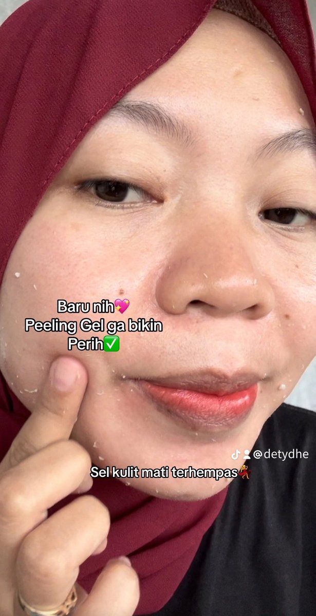 detydhe's tweet photo. PEELING GEL GAK BIKIN PERIH‼️
🗣️"Siapa yang males exfoliasi ??? "
hayooo minimal seminggu sekali ya wajib angkat sel sel kulit mati biar kulit wajah lebih halus💃cuma 20rban Woyyyy 
🛒https://t.co/Uk9aDXwTSJ

#cantikmuhanasui #benerinskinbarrier https://t.co/0QbZaDDtbB
