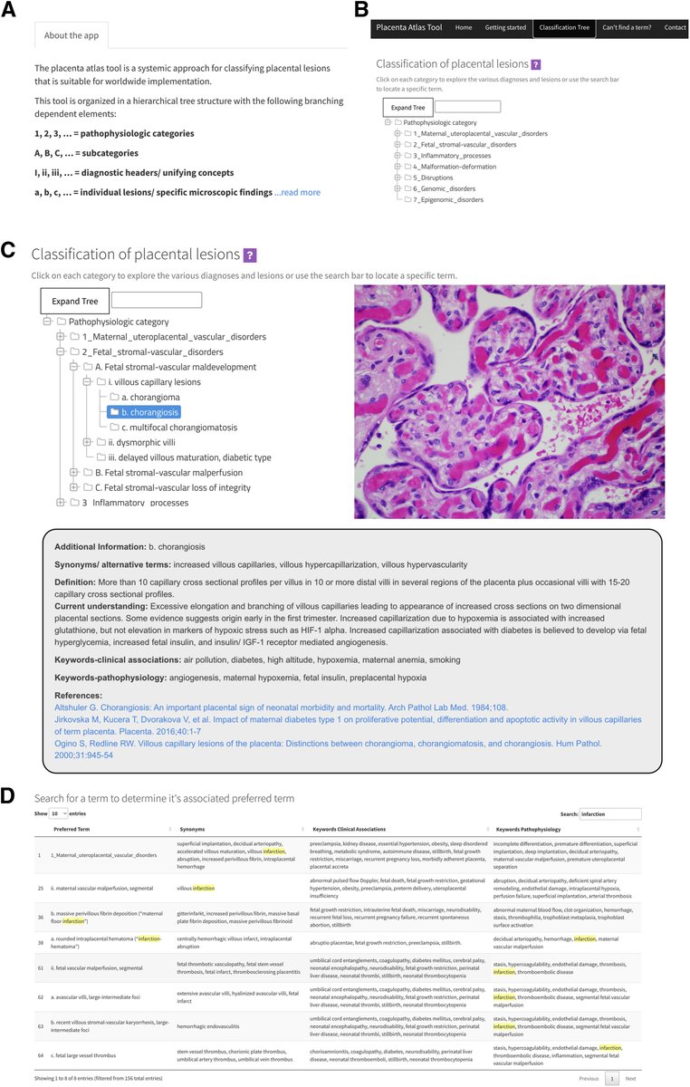 The Placenta Pathology Tool: an online application for understanding histopathologic lesions ow.ly/iLsH50Quk7j