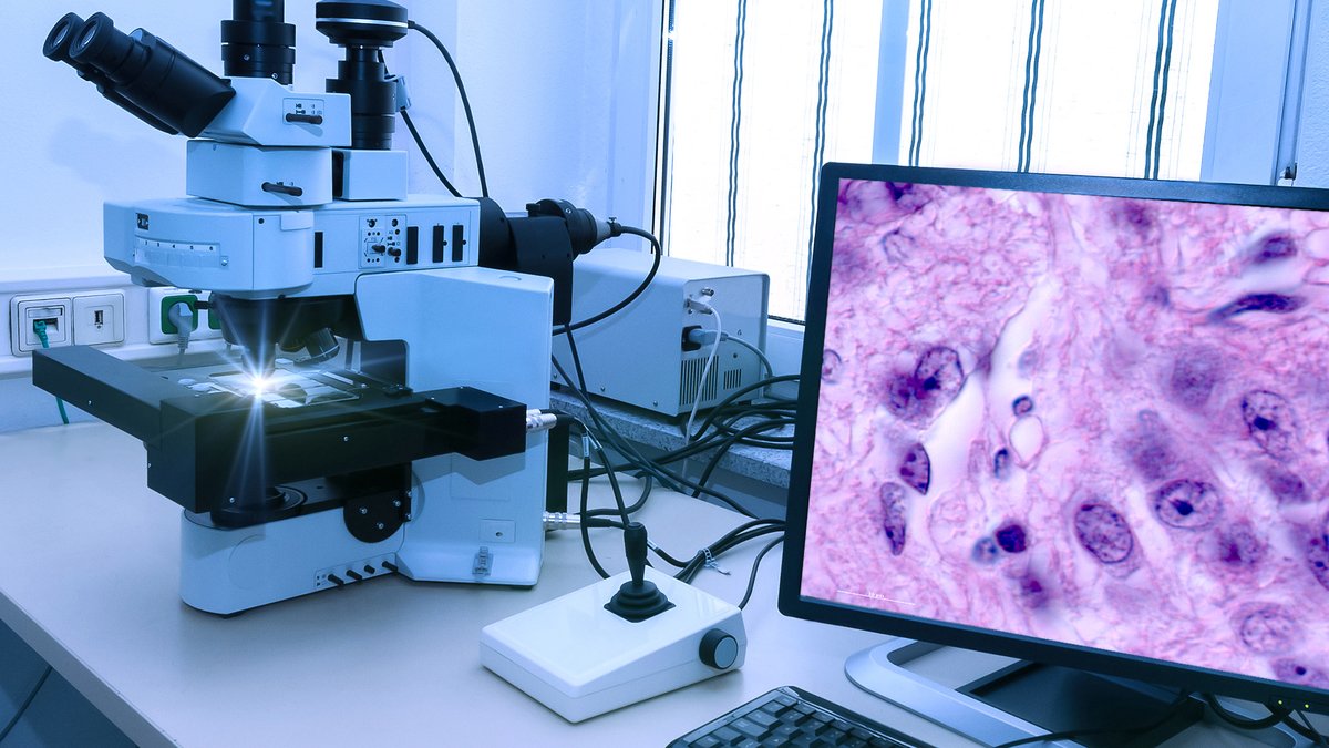 PoliTOnews's tweet image. Una diagnostica di qualità grazie allo spin-off del #PoliTO Aequip: si è aggiudicato il finanziamento bandito dallo #Spoke5 di #NODES e coordinerà il progetto DPLabS, per migliorare qualità e tempi di formulazione dei processi diagnostici

➡️polito.it/ateneo/comunic…

#PoliFlash