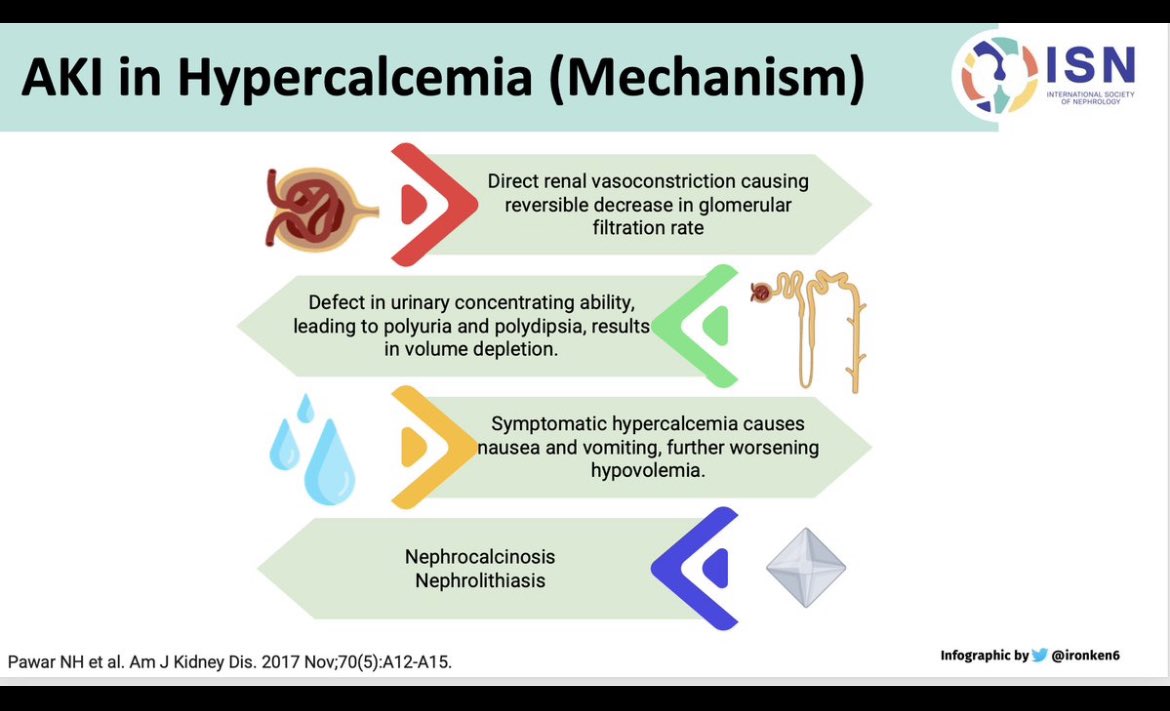 🔥Why AKI happens in hypercalcemia 🙄

🤷‍♀️Jasmine from Chandigarh #ECNeph 

✅Direct renal vasoconstriction 

✅Defect in urine concentration-polyuria-pre renal AKI

✅Hypercalcemia induced vomiting-Pre renal AKI 

@ISNeducation @ISNkidneycare 
👇Infographic by @Ironken6