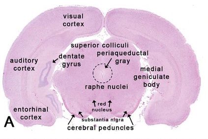 Does anyone know how to dissect the dorsal raphe nucleus of a rat brain? Please contact me 🥹 #phdchat #AcademicTwitter