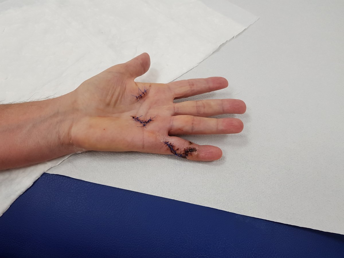 ReHand tweet media