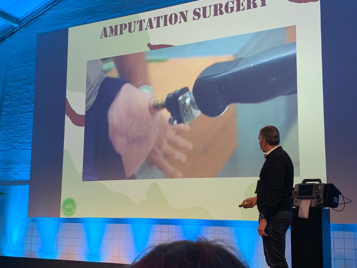 Trauma surgeon Oscar van Waes shares his knowledge on trauma surgery from extensive experience in treating warzone injuries and how it leads to innovations in surgical techniques and roads to recovery through osseointegration.