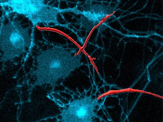 Biomedical Picture of the Day BPoD (@bpod_s) on Twitter photo Structure & functional changes underlying #neurons' impaired excitability characteristic of the #neurodegenerative disease #ALS #MND. Image & research by <a href="/PeteHarley95/">Pete Harley</a> et al Ivo Lieberam & <a href="/jbneuro/">Juan Burrone Lab</a> labs <a href="/dev_neuro/">CDN | King's College</a> in <a href="/CellReports/">Cell Reports</a>. On bpod.org.uk/archive/2024/1… Structure & functional changes underlying #neurons' impaired excitability characteristic of the #neurodegenerative disease #ALS #MND. Image & research by <a href="/PeteHarley95/">Pete Harley</a> et al Ivo Lieberam & <a href="/jbneuro/">Juan Burrone Lab</a> labs <a href="/dev_neuro/">CDN | King's College</a> in <a href="/CellReports/">Cell Reports</a>. On bpod.org.uk/archive/2024/1…