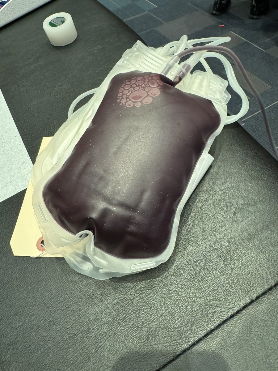 RosenbergerMd's tweet photo. Thank you, @RedCross and @DukeCancer for organizing this🩸drive. 👏 #FirstTimeDonor - done! ✅  had no idea its so fast… 3:30 🥴 @DukeSurgery - roll up those sleeves 💪 https://t.co/9u6fpW7rFk