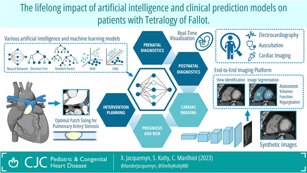 This review summarizes the Lifelong Impact of Artificial Intelligence and Clinical Prediction Models on Patients With Tetralogy of Fallot by @XanderJacquemyn @ShelbyKuttyMD and Dr. Cedric Manlhiot from @HopkinsMedicine. 👉 cjcpc.ca/article/S2772-… 🌎#CJCPC 1/8