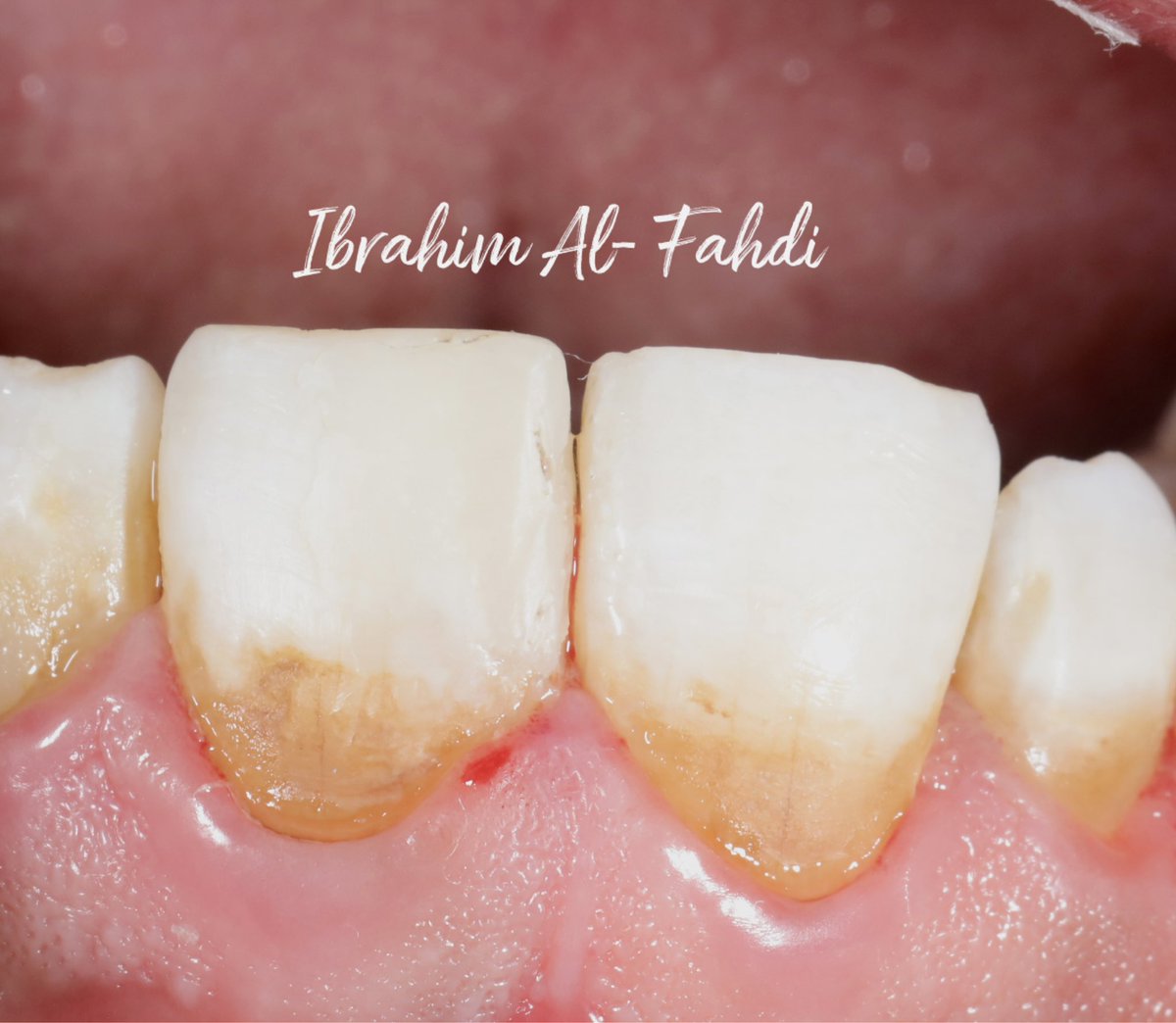 Cl IV # 21 

أحب الخميس والريستو 🌹

#الخميس_الونيسᅠ