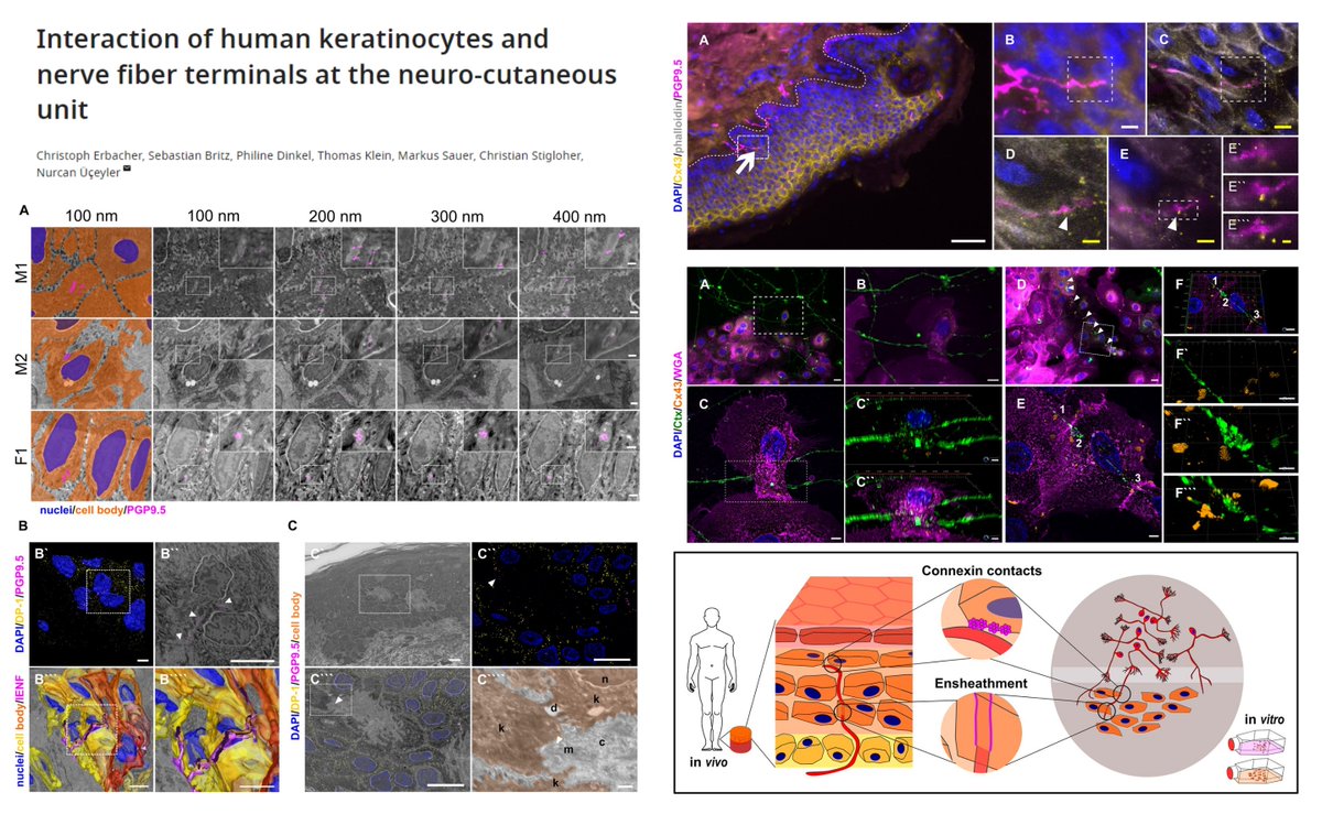 'Cx43 plaques as potential keratinocyte-nerve fiber communication sites' in👤Skin

#SuperResolutionArrayTomography
#ExpansionMicroscopy

+Coculture hiPSC-sensory neuron + primary keratinocyte to model physical ensheathment & Ca2+ coupling

@eLife 2024
elifesciences.org/articles/77761