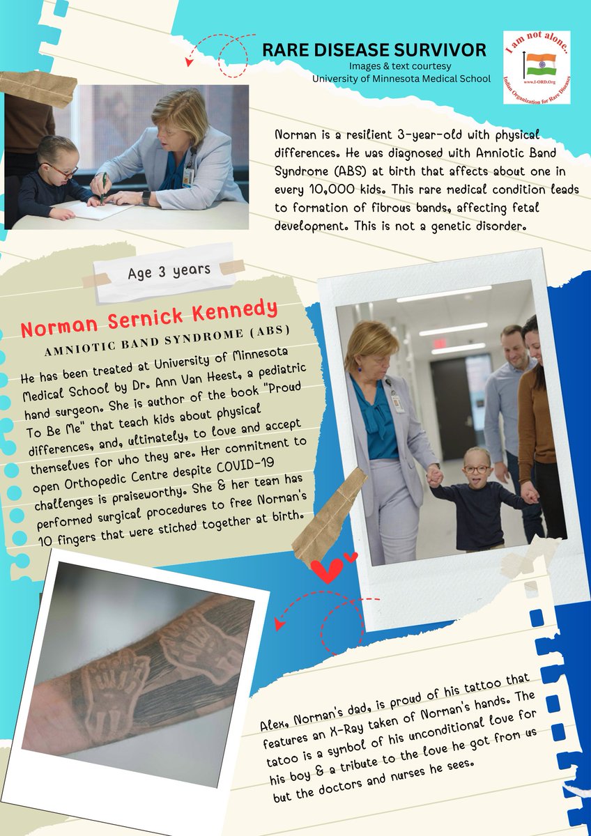 3-yr-old Norman was diagnosed with a #raredisease called Amniotic Band Syndrome (ABS) that affects about one in every 10,000 kids & treated at @umnmedschool Check this inspiring picture story 🙂 #amnioticbandsyndrome #UMNmed wherediscoverycreateshope.umn.edu/orthopedic_sur…