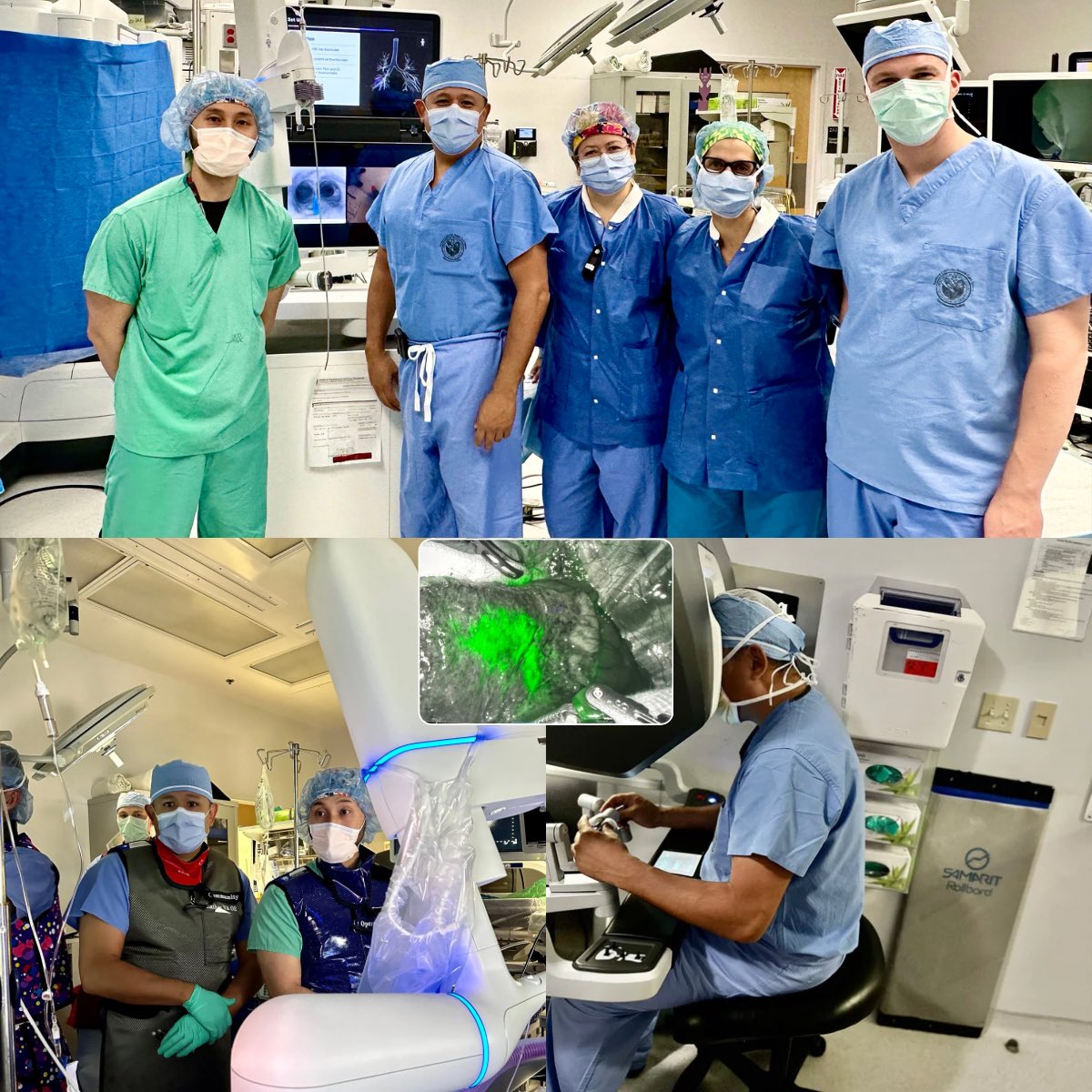 We are proud to share that our Sacramento VA team utilized a fully robotic approach with Ion robotic assisted bronchoscopy and da Vinci surgical system to resect stage 1 lung cancer. The patient was discharged home in less than 24 hours lung cancer free! #team #LCSM