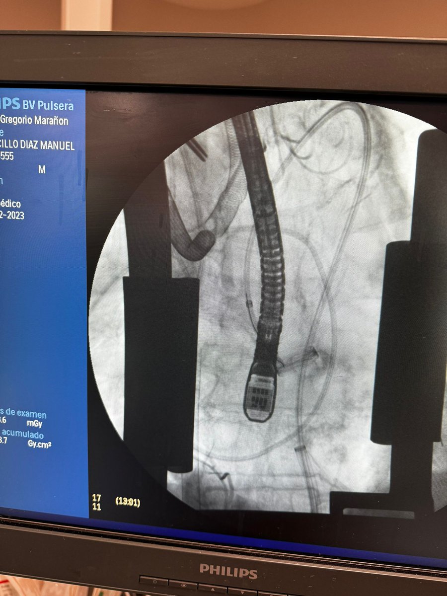 Cardiac Surgery Gregorio Marañon Hospital tweet media
