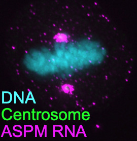 Matthew Taliaferro (@jmtali) on Twitter photo Excited to share our newest publication by <a href="/HYG_Lo/">Hei-Yong Grant Lo</a> in collaboration with Chad Pearson! We show that ASPM protein and RNA are localized to different sides of the centrosome. micropublication.org/journals/biolo… Excited to share our newest publication by <a href="/HYG_Lo/">Hei-Yong Grant Lo</a> in collaboration with Chad Pearson! We show that ASPM protein and RNA are localized to different sides of the centrosome. micropublication.org/journals/biolo…