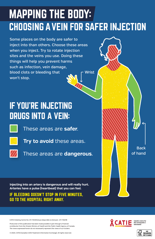 CATIEinfo's tweet image. Many harms from injecting drugs can be minimized by choosing a safer vein. 
Display our new poster and provide a clear visual reference to help prevent harms such as infection, vein damage and blood clots.

#harmreduction #saferuse #cdnhealth

orders.catie.ca/book/mapping-t…