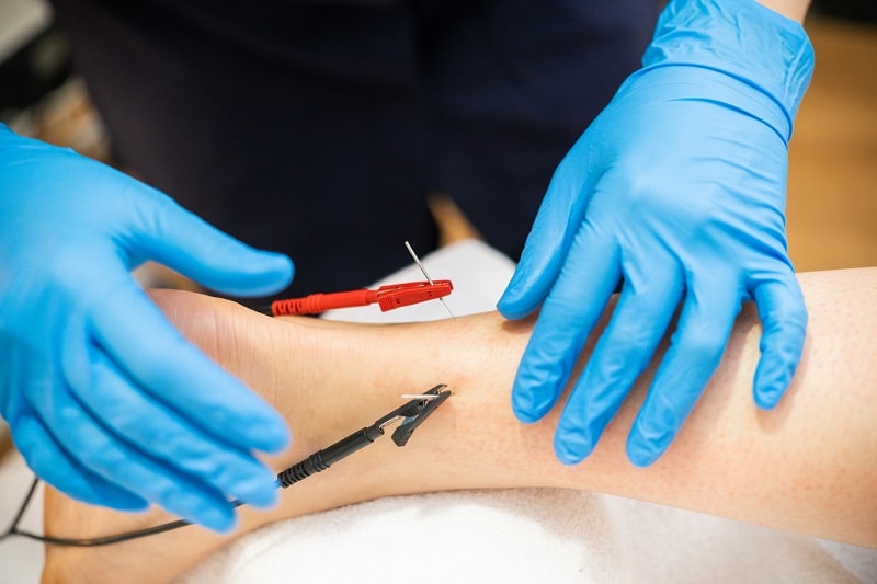 ProActiveAZ's tweet image. Dry needling stimulates the release of endorphins, the body’s natural painkillers, to help reduce inflammation and improve muscle function. Dr. Sarah Wannlund gives us the 411 on how it works.

proactivept.com/blog/dry-needl…