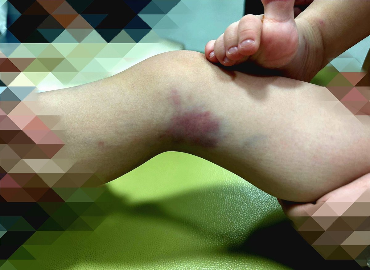 滝沢ガレソ tweet media