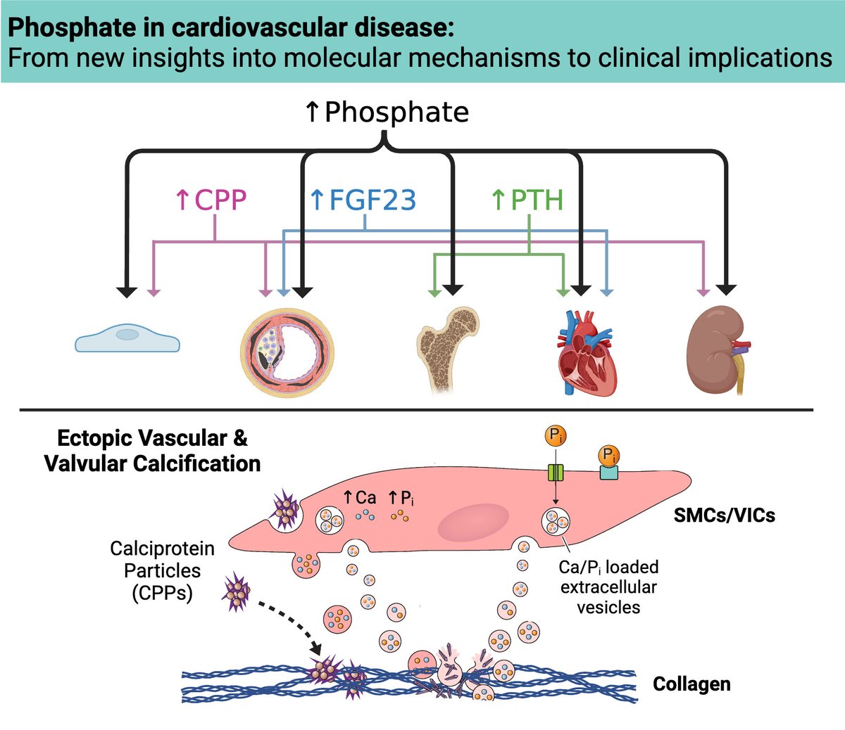 A review exploring advances in our understanding of phosphate (dys)regulation and #CVD impacts in both patients with #CKD and the general population @mandyturner_ @AikawaElena ahajrnls.org/3OjrIXv