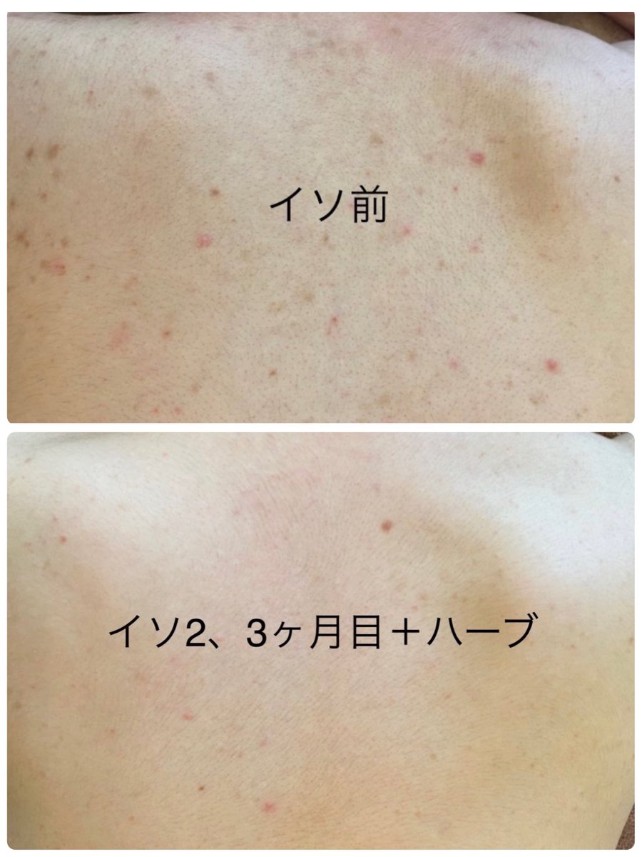 178せんち！！ tweet media