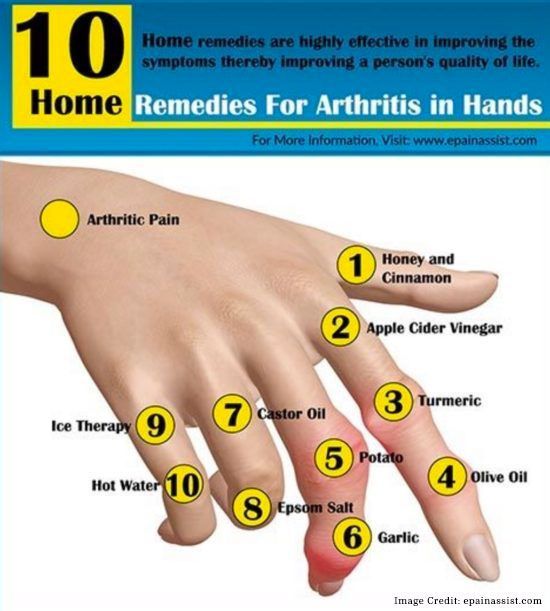 TipPediatric's tweet photo. Hand Arthritis Home Remedies https://t.co/mP8rwu12qi