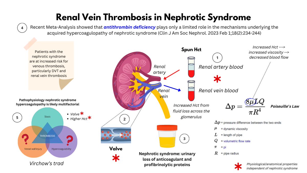 1/5 RENAL VEIN THROMBOSIS IN NEPHROTIC SYNDROME Nephrotic syndrome is associated with an acquired hypercoagulopathy that is associated with an increased risk of renal vein thrombosis (and VTE). What are the mechanisms underlying this propensity?