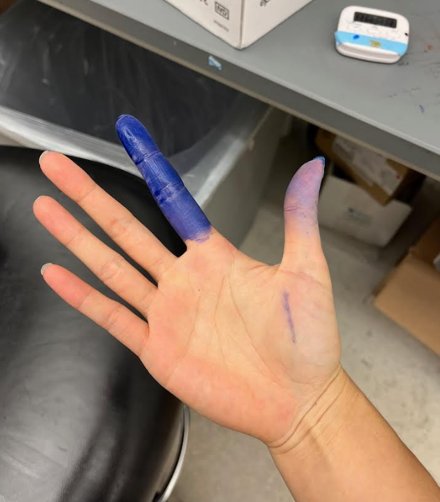 Realized I had a nick in my glove but I was not prepared for what was underneath