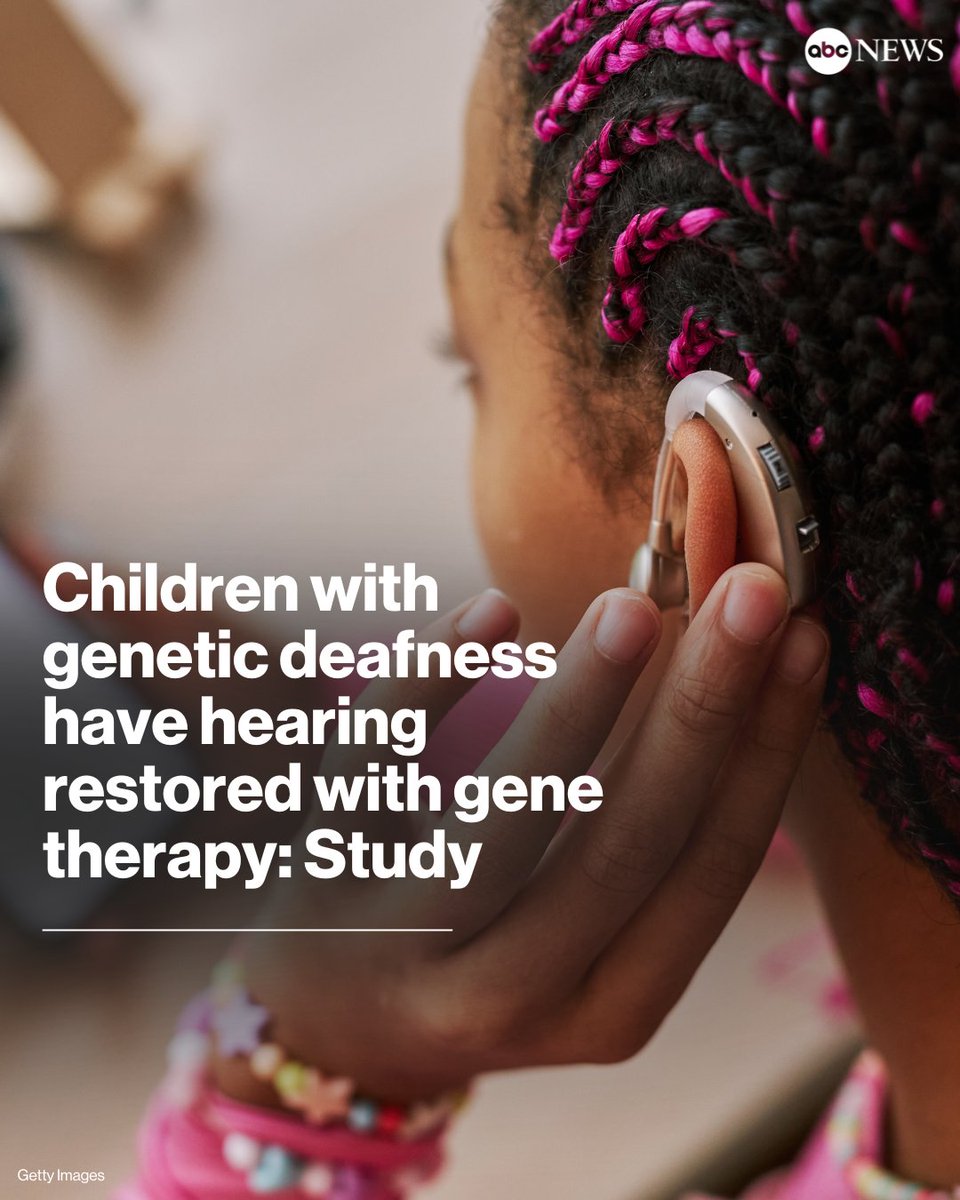 Several children with hereditary deafness regained their hearing thanks to a first-of-its-kind gene therapy, a new study found. trib.al/be6kUQP