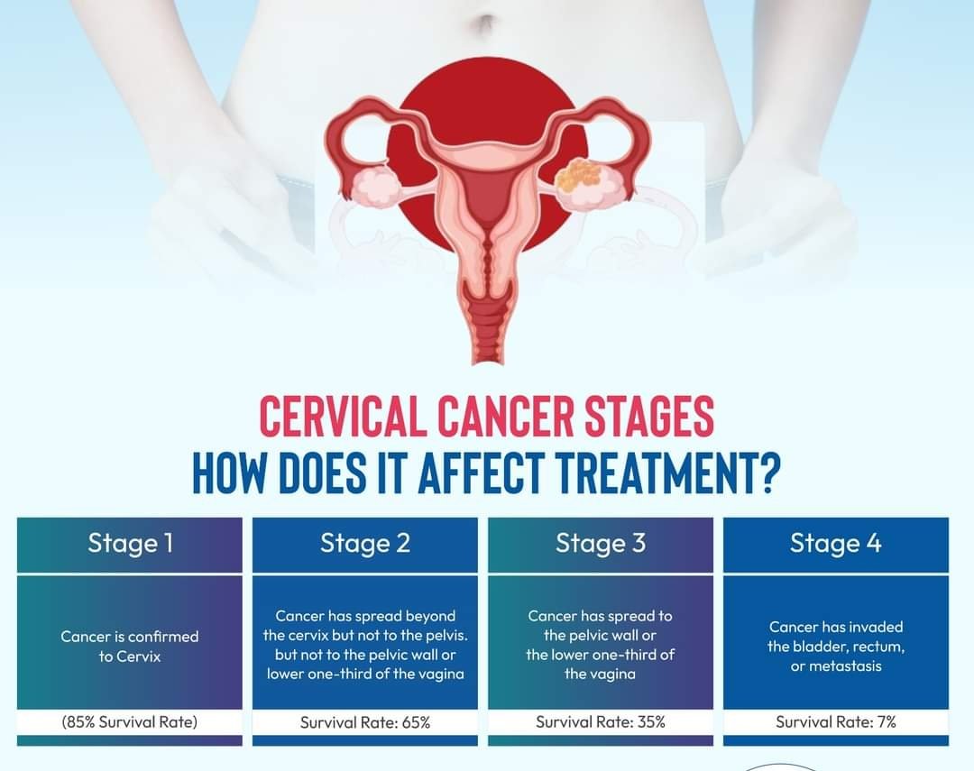 Stage 4: Critical, invading bladder, rectum, or metastasis, with a challenging 7% survival rate. Early detection is key for personalized treatment. Regular screenings and comprehensive care are vital. 

#drpratikpatil #knowthestages #nestofhopecommunity #uicc #ncs #Cervivor