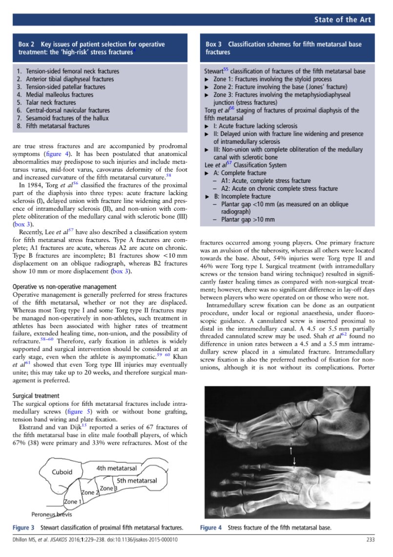 ⚽🦴Stress fractures in football sciencedirect.com/science/articl….