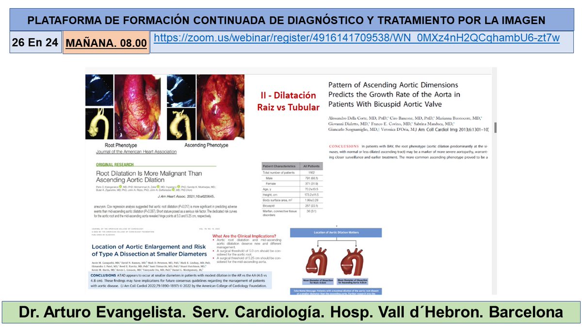 Salvador Pedraza (@salvasapedraza) on Twitter photo Great lecture by Dr Artur Evangelista about ” Imaging predictors in aortic pathology. II Course on Advances in Cardiac Imaging” moderated by Dr Victor Pineda. <a href="/hospitalclinic/">Hospital Clínic</a> <a href="/SEICAT_RAD/">SEICAT</a> <a href="/secardiologia/">Soc Esp Cardiología</a> <a href="/idibaps/">IDIBAPS</a> <a href="/Radiolegs_CAT/">radiolegscatalunya</a> @seram_rx <a href="/iasgirona/">Institut d’Assistència Sanitària</a> <a href="/AreaHjt/">Àrea Imatge Cardiotoràcica IDI Girona</a> <a href="/myESR/">myesr</a> <a href="/RSNA/">RSNA</a> Great lecture by Dr Artur Evangelista about ” Imaging predictors in aortic pathology. II Course on Advances in Cardiac Imaging” moderated by Dr Victor Pineda. <a href="/hospitalclinic/">Hospital Clínic</a> <a href="/SEICAT_RAD/">SEICAT</a> <a href="/secardiologia/">Soc Esp Cardiología</a> <a href="/idibaps/">IDIBAPS</a> <a href="/Radiolegs_CAT/">radiolegscatalunya</a> @seram_rx <a href="/iasgirona/">Institut d’Assistència Sanitària</a> <a href="/AreaHjt/">Àrea Imatge Cardiotoràcica IDI Girona</a> <a href="/myESR/">myesr</a> <a href="/RSNA/">RSNA</a>