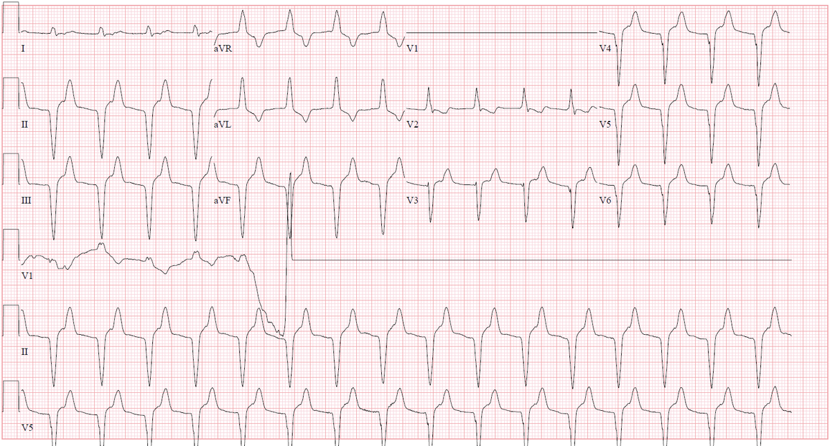 ECG Reid tweet media
