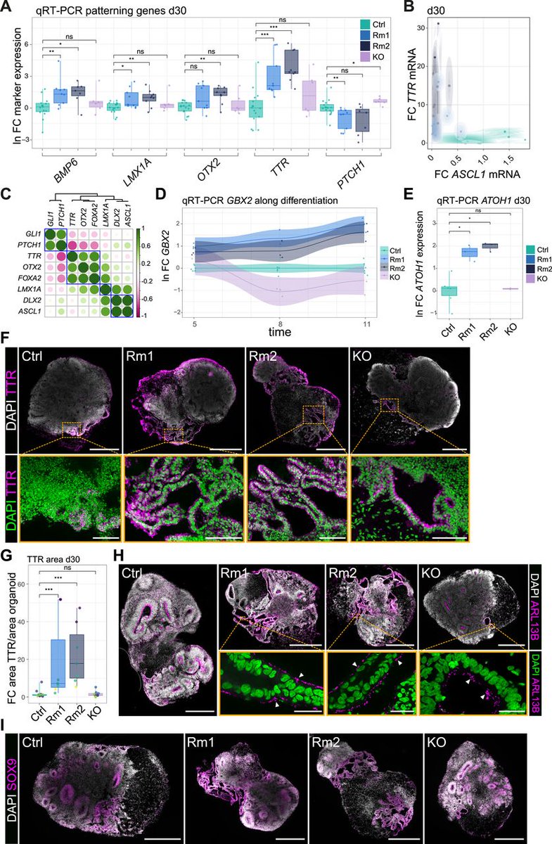 Check out this paper recently published in LSA: Absence of the RING domain in MID1 results in patterning defects in the developing human brain <a href="/UniFAU/">FAU Erlangen-Nbg</a> @falk_lab <a href="/karow_lab/">Karow Lab</a> 
hubs.la/Q02h0m5t0