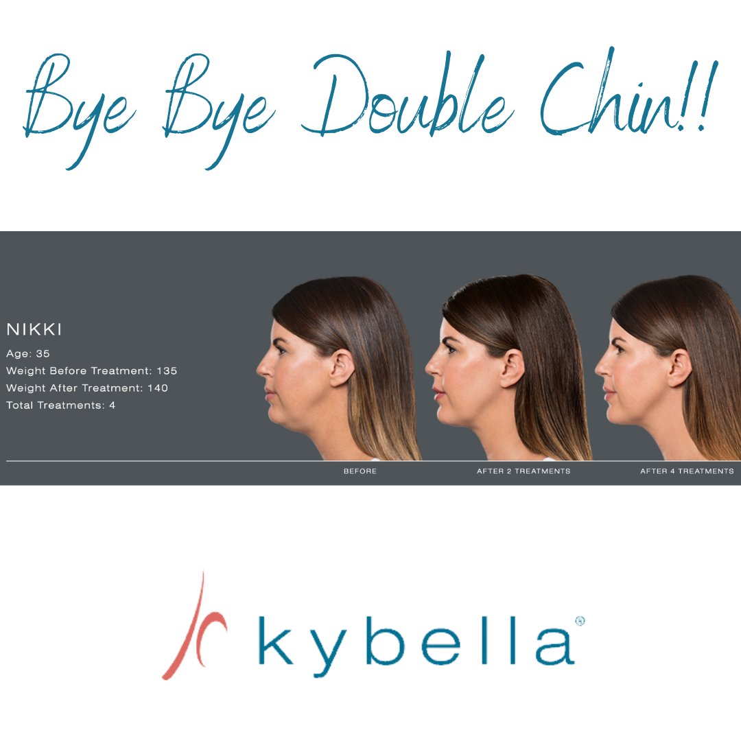 Do you have some extra fullness beneath your chin? Maybe it's something you've had your whole life, something that developed over the years, or something you noticed recently. Kybella can take care of that! #selfcare #medspa #kybella #doublechin #beauty #celebrity