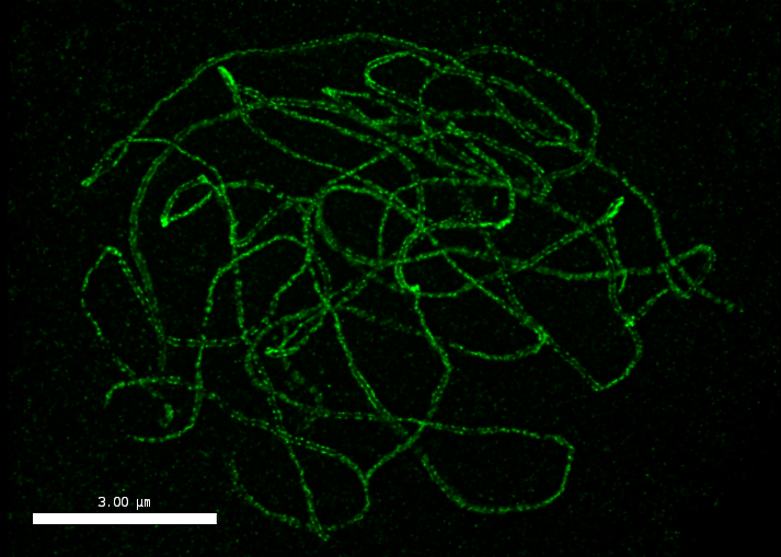 SVI Huygens (@svi_huygens) on Twitter photo Happy #FluorescenceFriday and congratulations to Stéphanie Durand <a href="/brussolette/">durand</a>, Dept. of Chromosome Biology, <a href="/Raph_Mercier/">raphael mercier</a> lab <a href="/mpipz_cologne/">MPIPZ Cologne</a> for her 2nd place in the Huygens Image Contest, with this deconvolved STED.
svi.nl/ImageContestWi…
#microscopy #bioimaging Happy #FluorescenceFriday and congratulations to Stéphanie Durand <a href="/brussolette/">durand</a>, Dept. of Chromosome Biology, <a href="/Raph_Mercier/">raphael mercier</a> lab <a href="/mpipz_cologne/">MPIPZ Cologne</a> for her 2nd place in the Huygens Image Contest, with this deconvolved STED.
svi.nl/ImageContestWi…
#microscopy #bioimaging