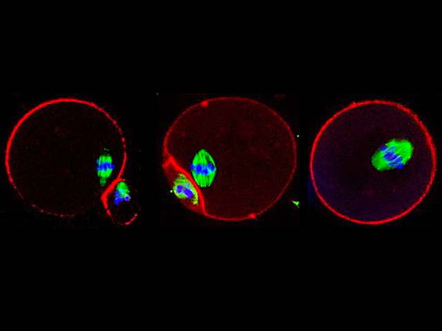 Biomedical Picture of the Day BPoD (@bpod_s) on Twitter photo #Cell adhesion molecule N-cadherin is essential for the development of #ovarian follicles and #ovulation. Image & research by Alaknanda Emery et al <a href="/RobsInstitute/">Robinson Research Institute</a> in <a href="/eLife/">eLife - the journal</a>. On bpod.org.uk/archive/2024/1… #Cell adhesion molecule N-cadherin is essential for the development of #ovarian follicles and #ovulation. Image & research by Alaknanda Emery et al <a href="/RobsInstitute/">Robinson Research Institute</a> in <a href="/eLife/">eLife - the journal</a>. On bpod.org.uk/archive/2024/1…